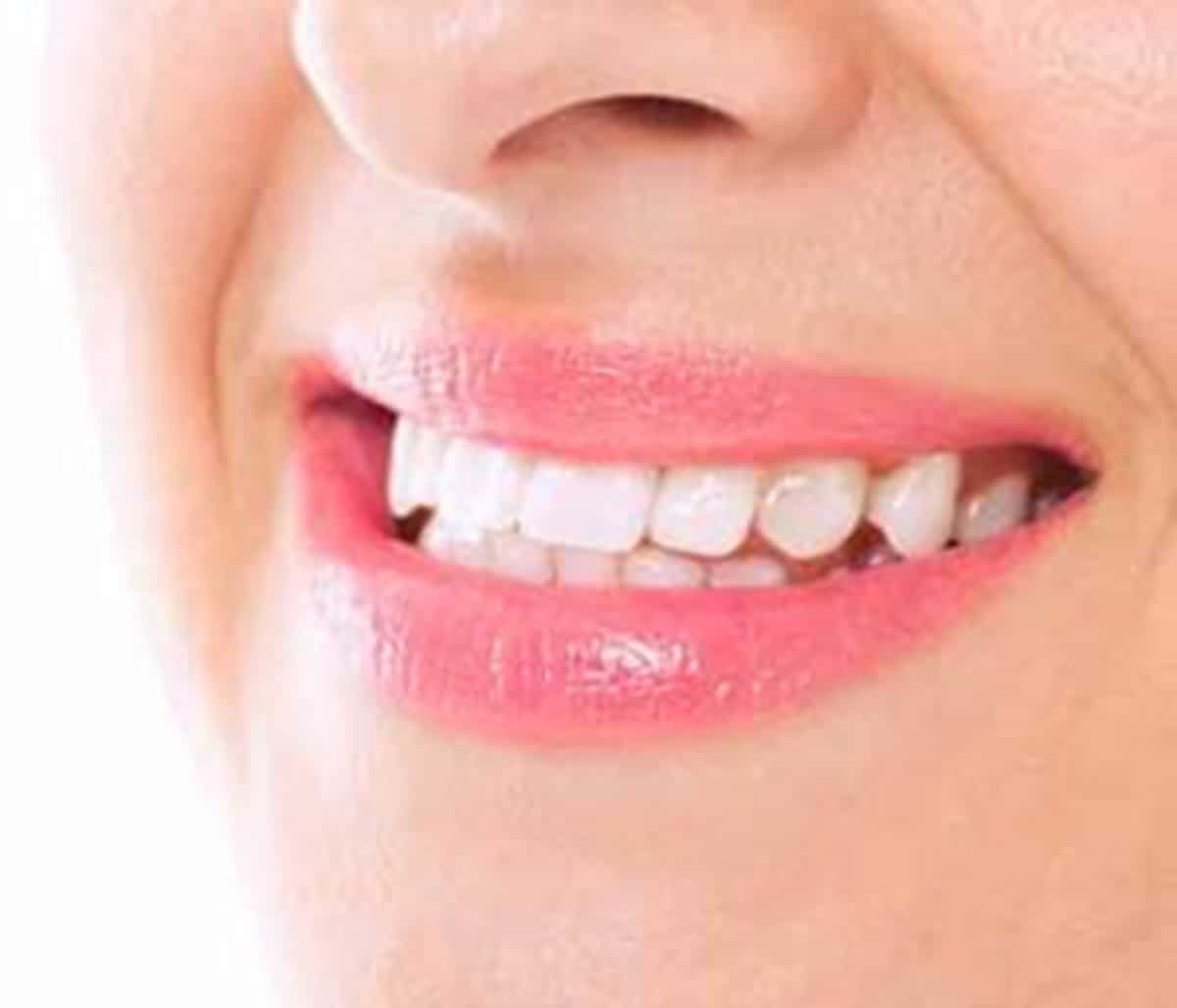 brighten smiles with professional teeth whitening.