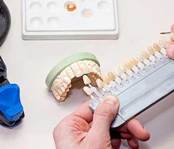 Dental Veneers from Dr. Anirudh Patel