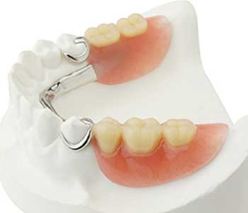 Dr. Anirudh Patel in Philadelphia area Dentist Describes Partial Dentures