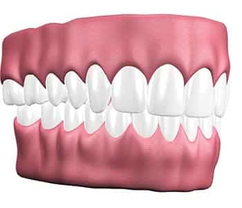 Philadelphia Dentist Gum Disease Treatment
