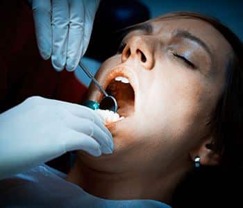Tooth Implant Procedure Philadelphia with Innovative Dental