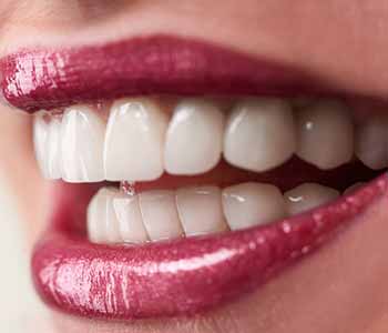 Tooth Whitening options available through Philadelphia dental office