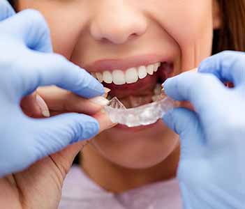 Innovative Dental has the best Invisalign dentist near you Philadelphia