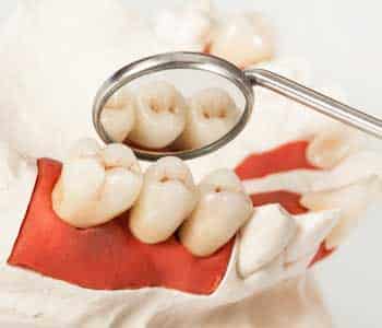 replace missing teeth, Innovative Dental