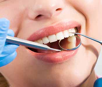 Six Month Smiles treatment from Innovative Dental in Philadelphia